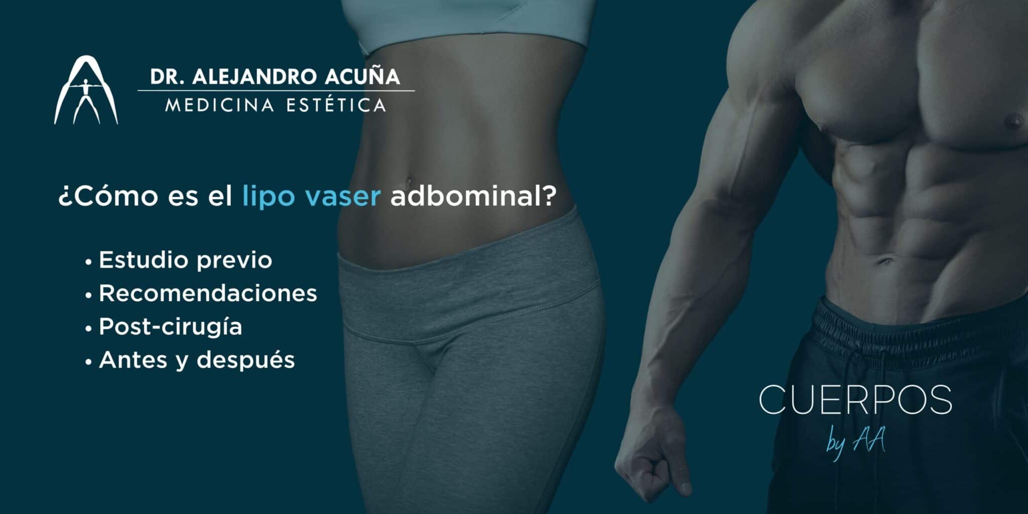 ¿Cómo es el lipo vaser Abdominal?