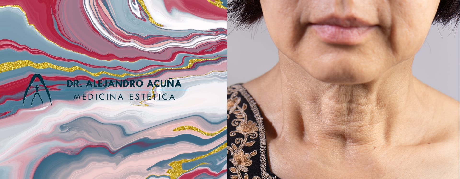 Renuvion facial: Resultados visibles desde la primera sesión en el tratamiento de la flacidez