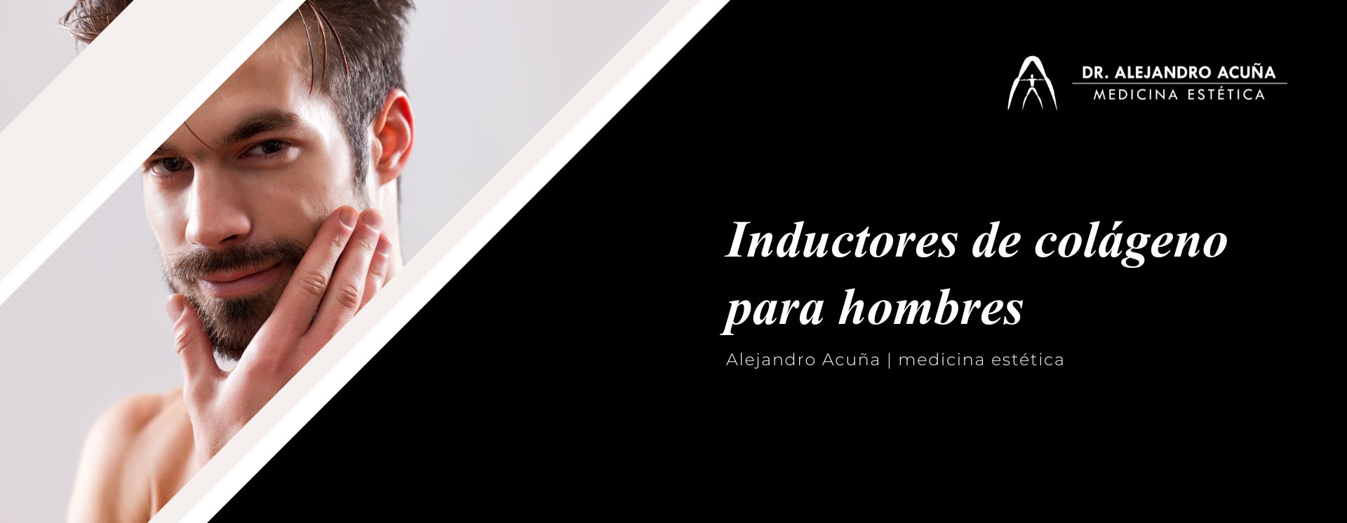Inductores de colágeno para hombres en 2026