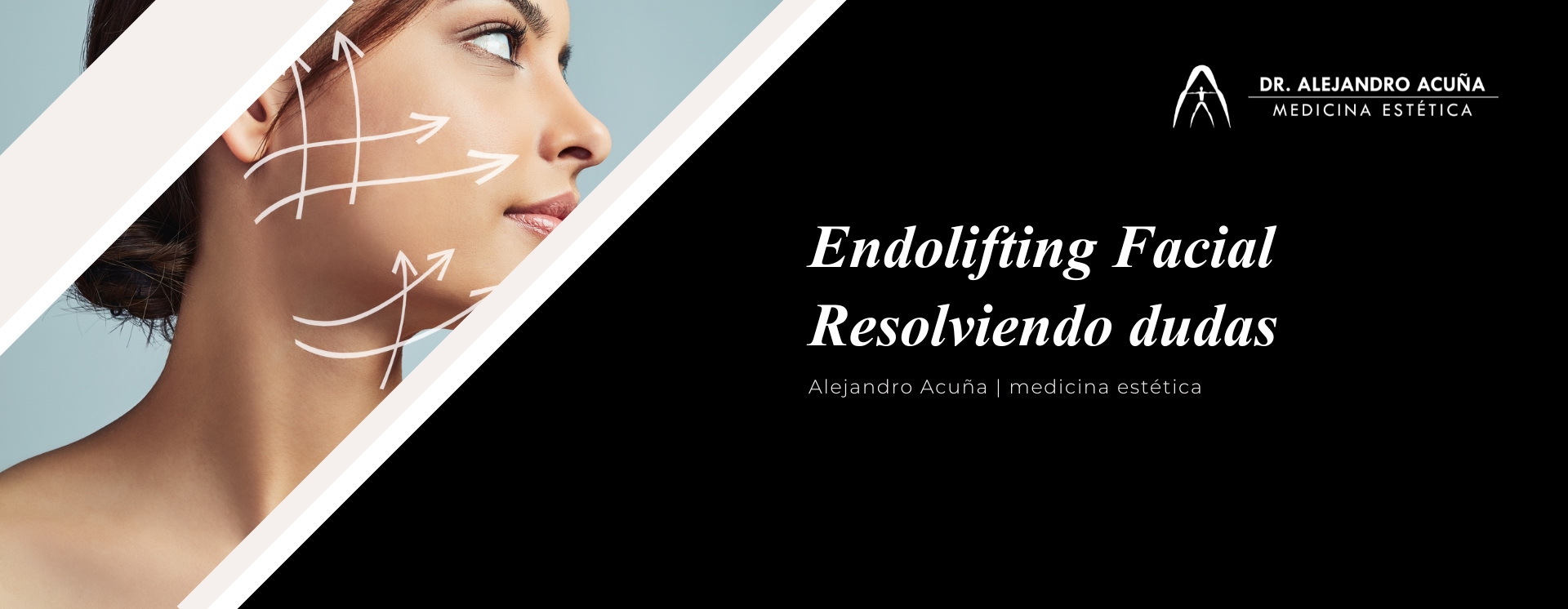 endolifting facial