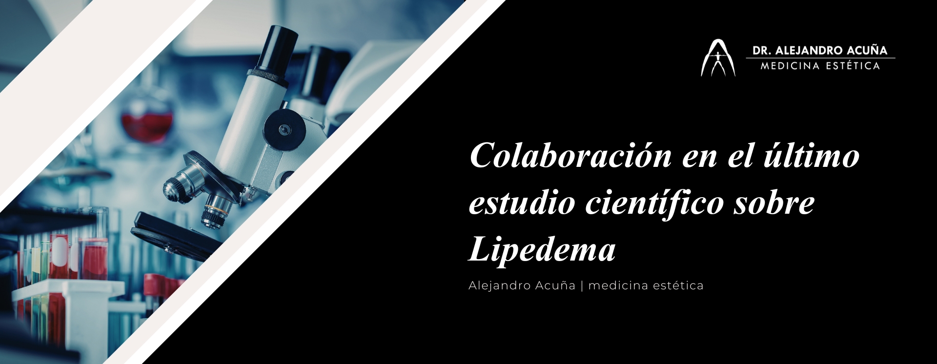 cirugia de lipedema estudio 2026