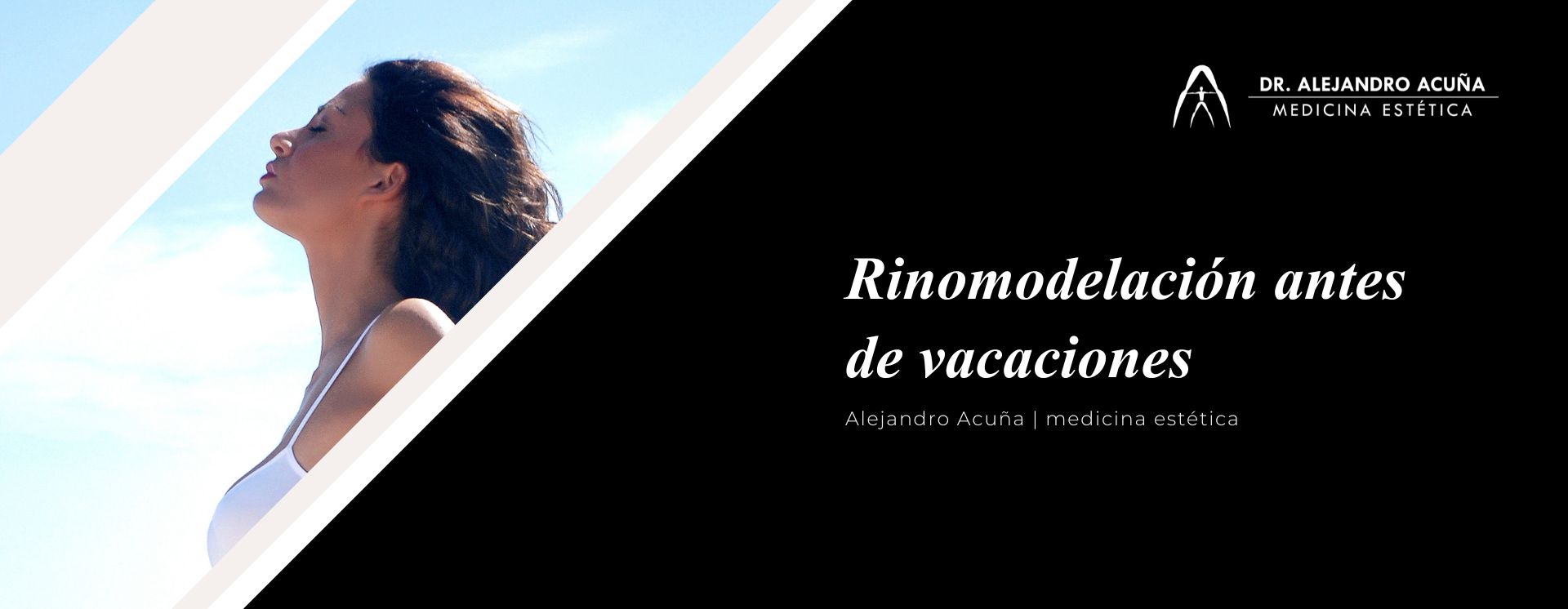 rinomodelación antes de las vacaciones de verano