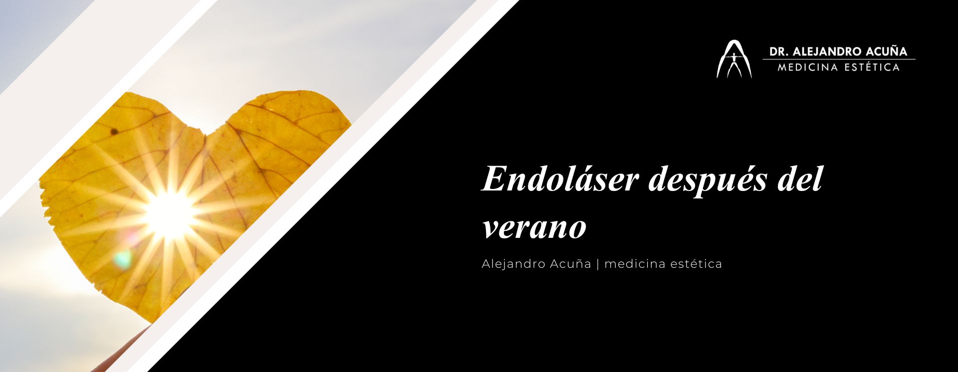 Endoláser después del verano